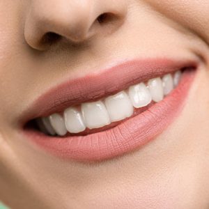 Ontstoken tandvlees - blog dental365