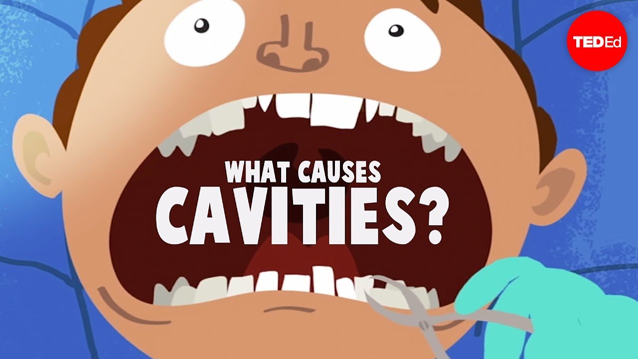 Gaatjes in tanden? | Behandelen en voorkomen - DENTAL365