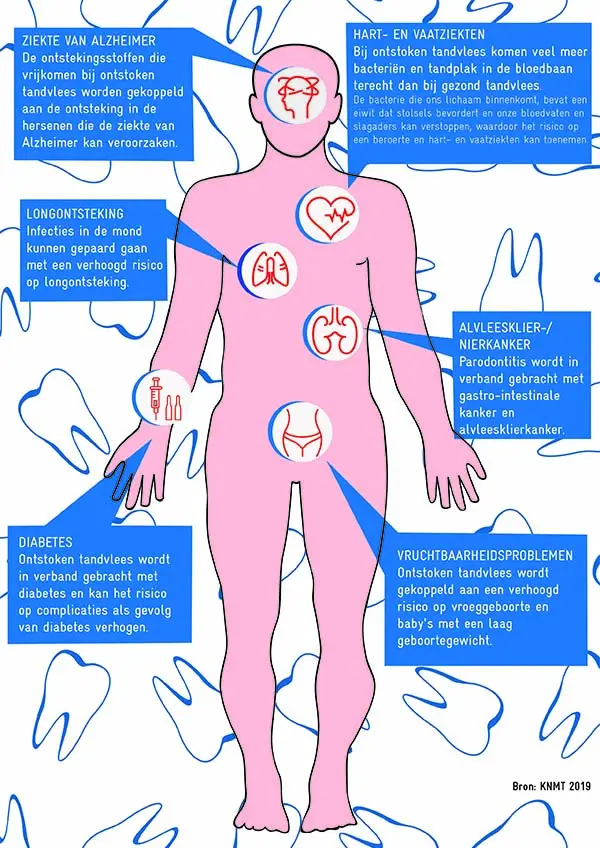 alles wat u moet weten over mondzorg en mondgezondheid dental365 mondhygienist