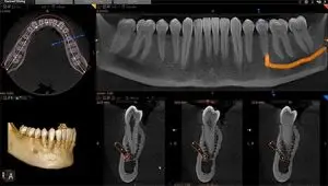 cbct-scan-3d-röntgen