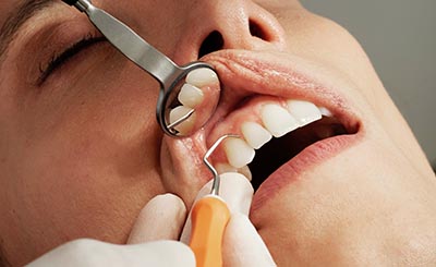 mondverzorging bij kinderen en volwassenen - dental365
