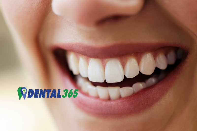 Waarom worden tandartscontroles en gebitsreinigingen elke 6 maanden gepland en uitgevoerd door de tandarts of mondhygienist - Dental 365